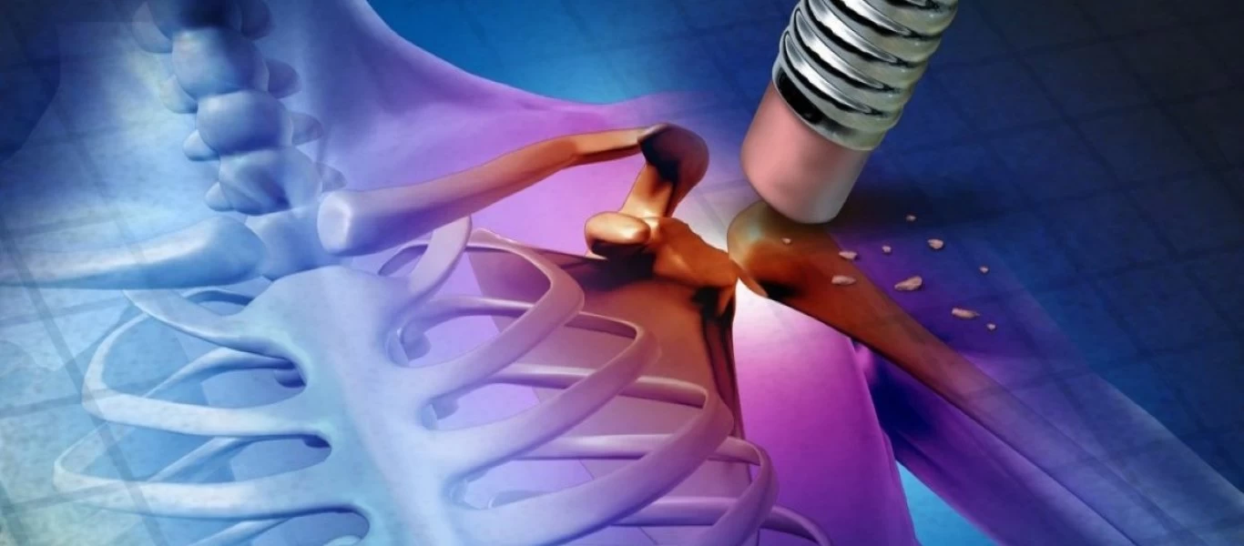 Oι τροφές που θα σας βοηθήσουν να απαλλαγείτε από την οστεοπόρωση